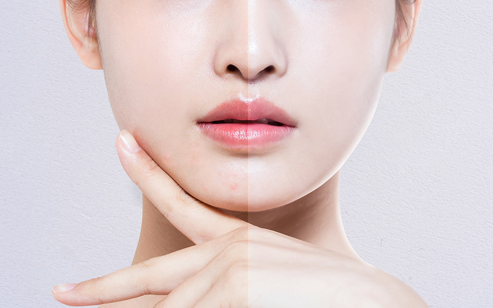 Unlocking K-Beauty: Your Essential Guide to Glowing Skin