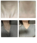 frommedi Nano-step Collagen Neck Mask 13g*5pack