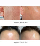 Arocell Super Collagen Booster Serum 70ml