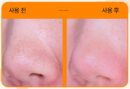 Hanskin Cleansing Balm & Blackhead 80g