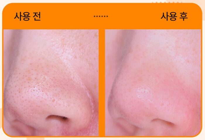 Hanskin Cleansing Balm & Blackhead 80g - Image 2
