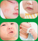 ATONO2 SOS Cream Around Mouth 20ml (100% Food Grade Ingredients!)