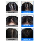 Refilled Cytokine Hair Tonic Booster Sensitive Care 100ml Hair Loss Relief