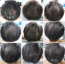 CELL RETURN Hair Alpha Ray S Scalp Massager