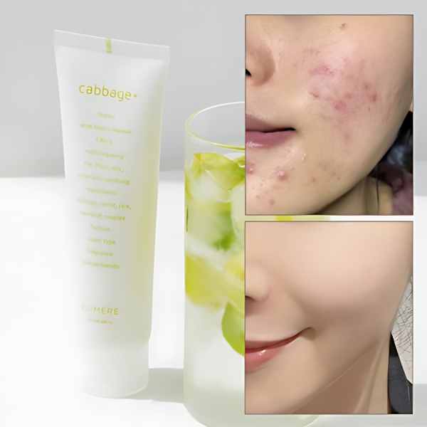 ELIMERE Cabbage Acne Foam Cleanser 120ml