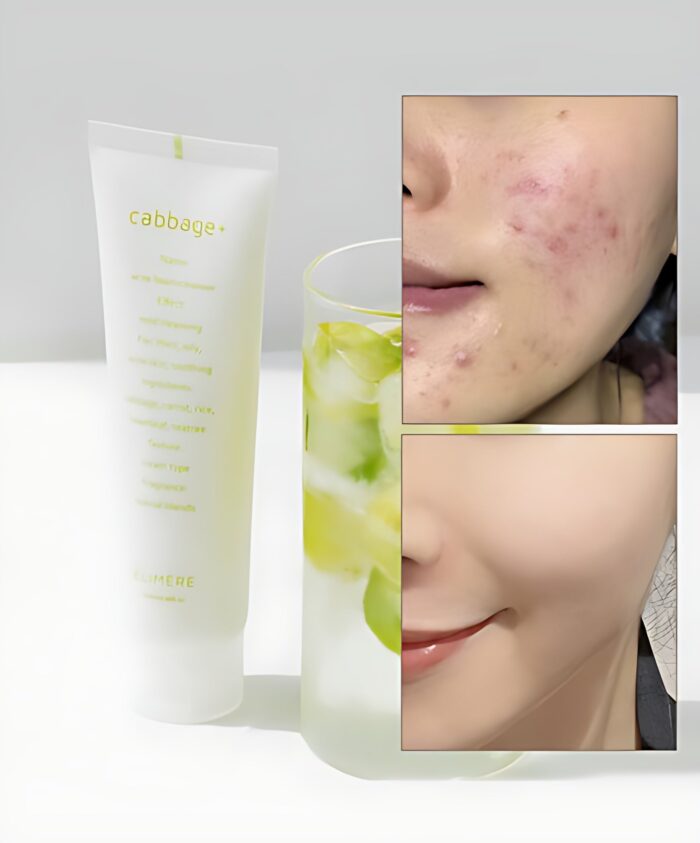 ELIMERE Cabbage Acne Foam Cleanser 120ml