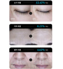 CHARDE Cloud Ampoule Kit