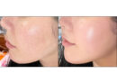 Pira Real Collagen Cheek Pack 1box