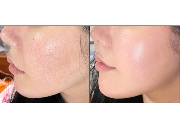 Pira Real Collagen Cheek Pack 1box - Image 2