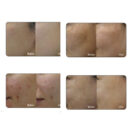 AuLabs Toning Activator 10ml*4ea