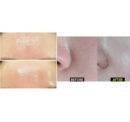 NOLA Pore Solution Collagen Mask Pack 4Sheets*41ml