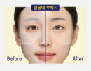 CKD Vitamin C Freckles Blemish Shot Mask 34g*10sheets