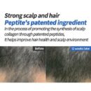 8grow Anti-Hairloss Pro Vitamin B5 Hair Tonic 100ml - EmpressKorea