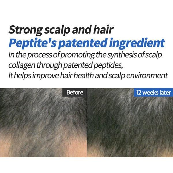 8grow Anti-Hairloss Pro Vitamin B5 Hair Tonic 100ml - EmpressKorea