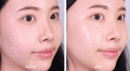 9wishes Dermatic AC3 Clear LHA Ampule 30ml - EmpressKorea