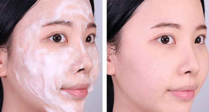 9wishes Dermatic AC3 Clear LHA Foam Cleanser 150ml - EmpressKorea