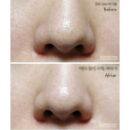Ciracle Blackhead Off Cotton Mask 20EA*5ml - EmpressKorea