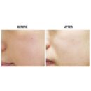 Crazy Skin Crazy Lifting Mask (5EA) - EmpressKorea