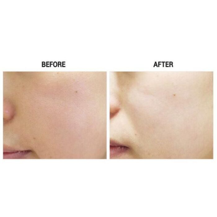 Crazy Skin Crazy Lifting Mask (5EA) - EmpressKorea