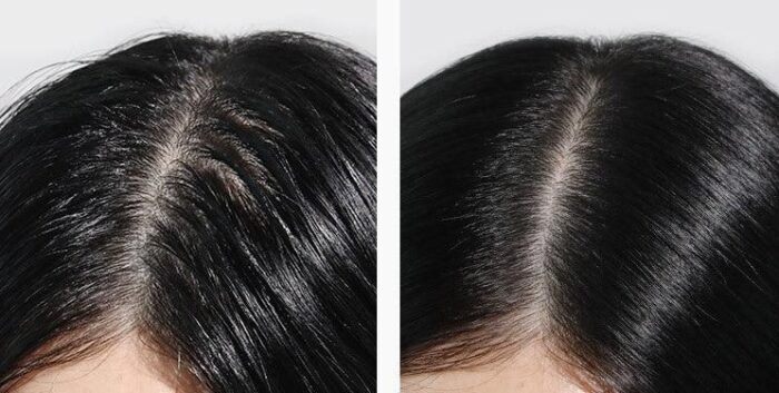 DASHU Daily Anti-Hair Loss Scalp Shampoo 500ml - EmpressKorea