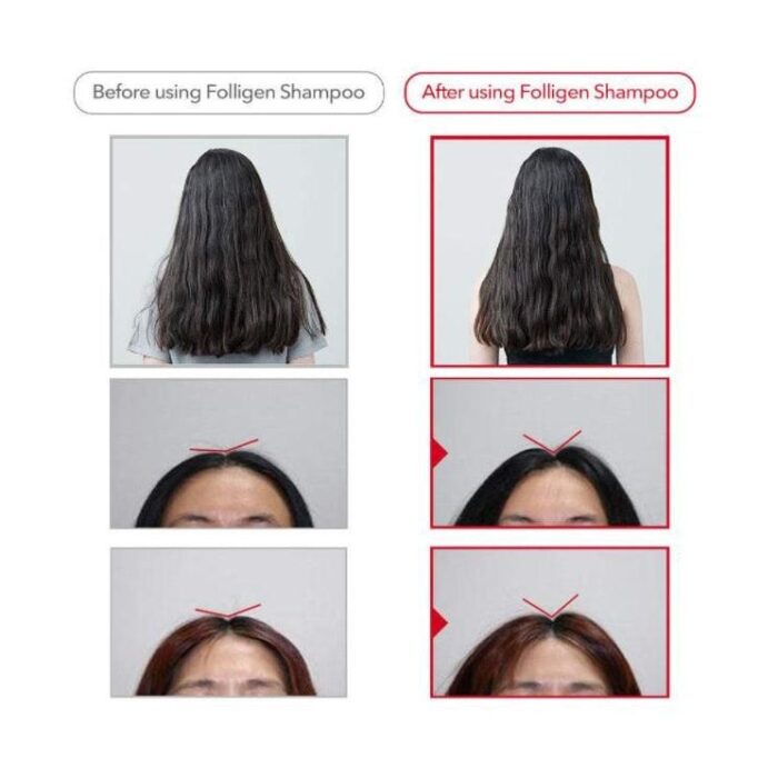 Dr.FORHAIR Folligen Original Shampoo 500ml - EmpressKorea