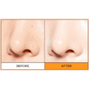 Dr.G Brightening Up Moisture Sun SPF 50+ PA++++ 50ml - EmpressKorea