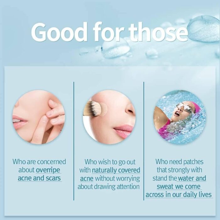 Pyunkang Yul ACNE Spot Patches 4 sheets 72pcs - EmpressKorea