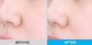 Shingmulnara Jeju Sparkling Water Pore Pad 155g 100EA - EmpressKorea