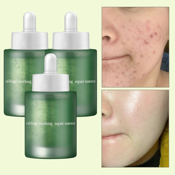 ELIMERE Cabbage Soothing Repair Essence 50ml