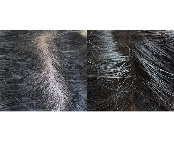 TRICONIX Trico-X Scalp Ampoule 30ml - Image 2