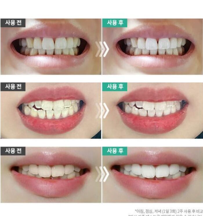 Liveorals Puredia Whitening Toothpaste 80g - Image 4