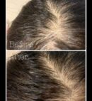 MEDIGROW Scalp Nutrition Anamona Booster 30tablets