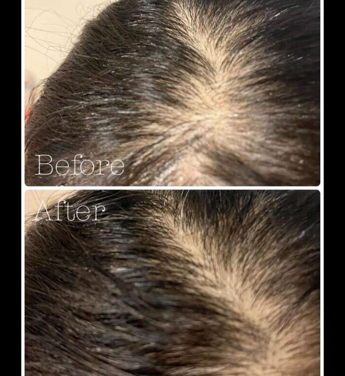 MEDIGROW Scalp Nutrition Anamona Booster 30tablets - Image 2