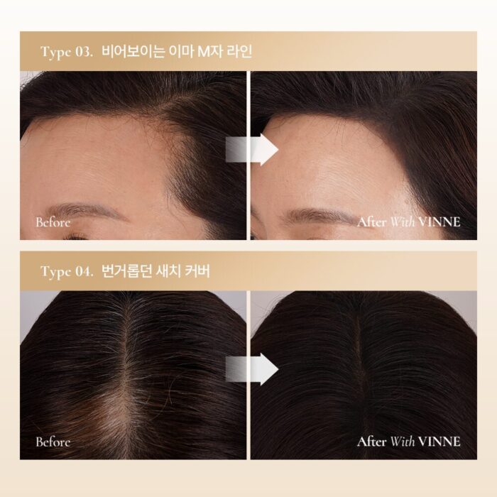 VINNE All Cover Perfect Hair Cushion Stick 5.1g - Image 4
