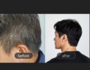 MED:ALL RCP Professional Hair Color 180g/180g 1Box / 3Box