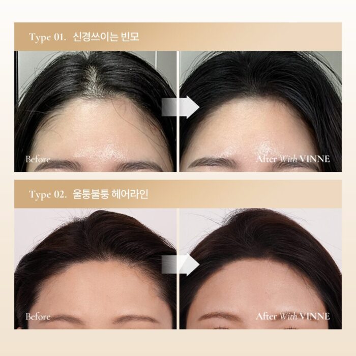 VINNE All Cover Perfect Hair Cushion Stick 5.1g - Image 2