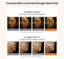 MediAnswer Collagen Lift Up Band 3.8g*4EA - EmpressKorea