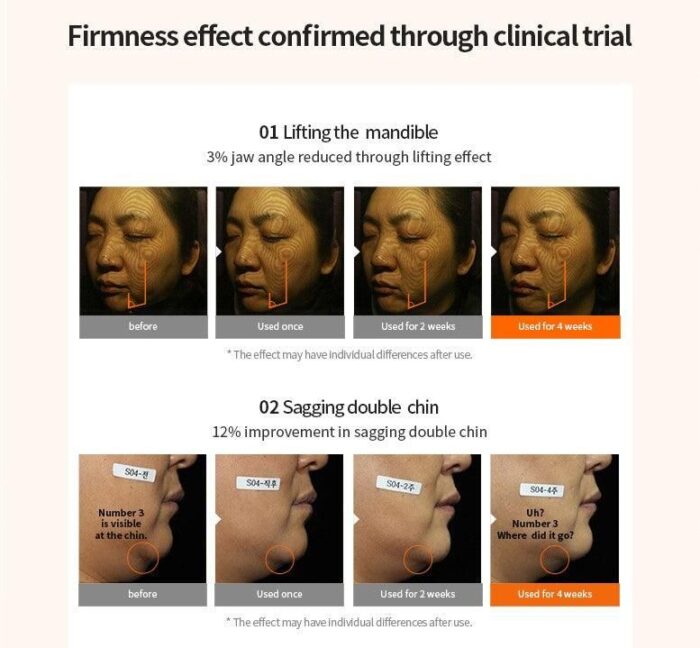 MediAnswer Collagen Lift Up Band 3.8g*4EA - EmpressKorea