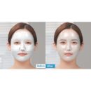MediAnswer Pore Collagen Mask 37g*5EA - EmpressKorea