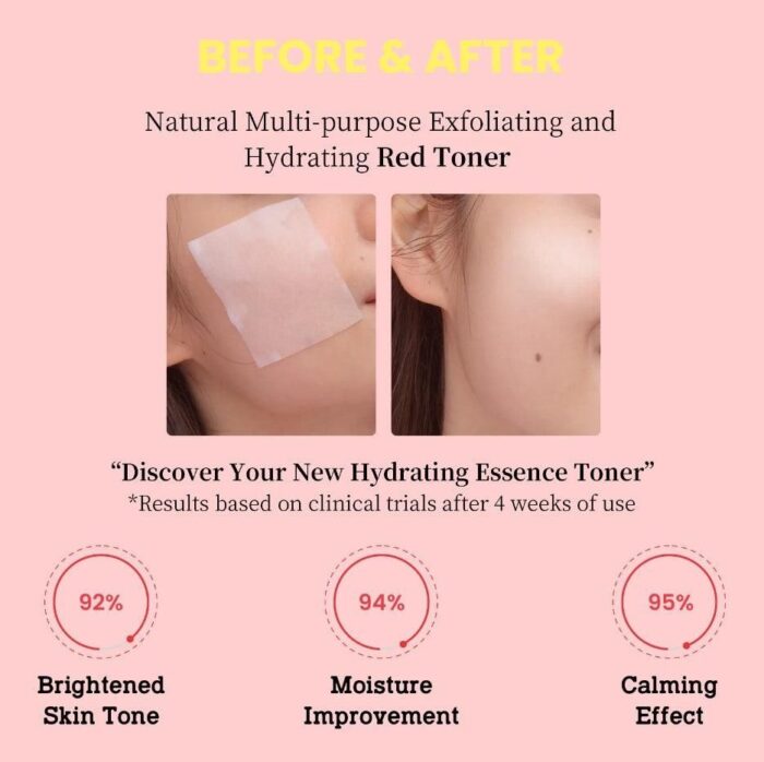 Tovegan Red Remedy Toner 150ml - EmpressKorea