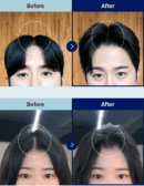 DASHU Daily Volume Pick Forehead Root Volume