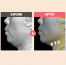 YAKSON BEAUTY V-Like Lifting Patch 9.5g*7pack