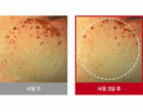 RAVIEL Acerola Dark Spot Blemish Care Cream 80ml - Facial Milla/Flat Warts Improve