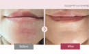 ERKENA PDRN Skin Booster Ampoule 5ml*8bottle