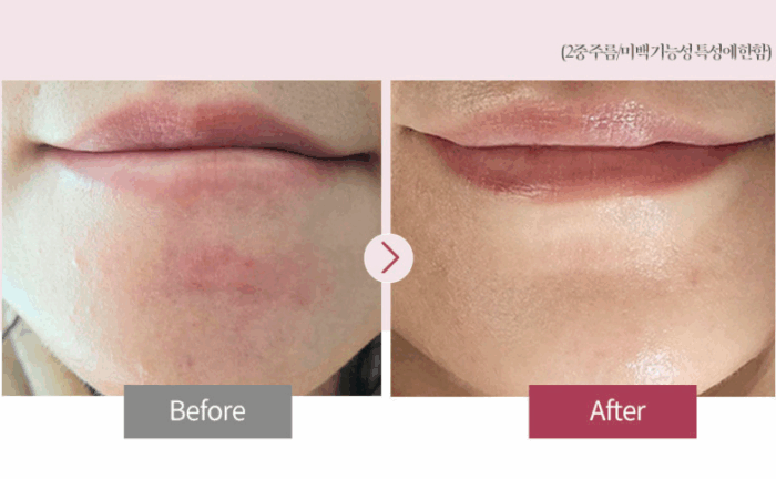 ERKENA PDRN Skin Booster Ampoule 5ml*8bottle - Image 2