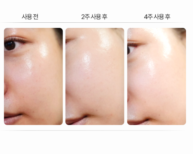 GASH Perfect Mela Zero Air Bubble CDS™ Mask 80ml - Cosmetics - View 1