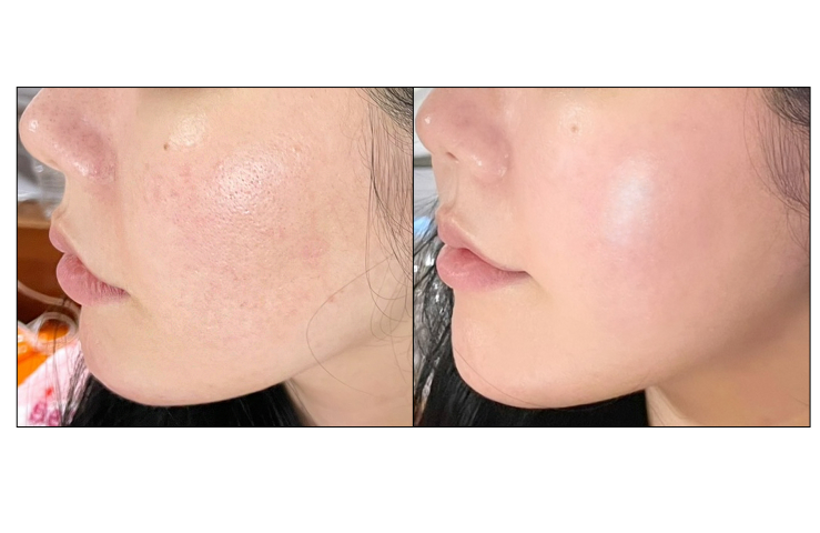 onslow Real Collagen Cheek Pack 7 Sheets - Cosmetics - View 1