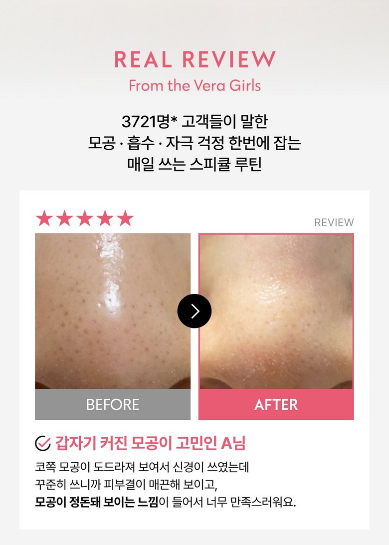 VERAMORE Pore Tightening Spicule 300 Ampoule Detail